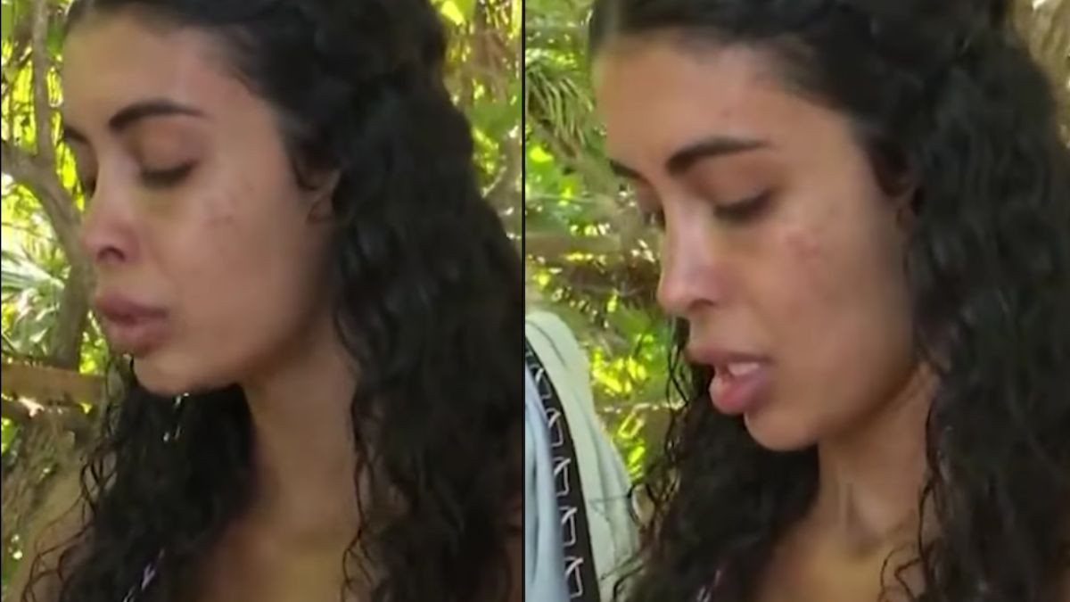 Isola dei Famosi, Ahlam costretta a ritirarsi? Fasciate entrambe le braccia!